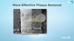 More Effective Plaque Removal - Independent Study