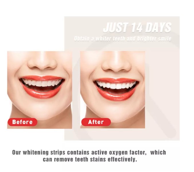 نوار سفیدکننده دندان هیدروژن پروکساید 6% GlorySmile - Dry Teeth Whitening Stripes